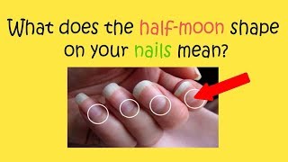 6 Major Health Problems the Moons on Your Nails Warn You About