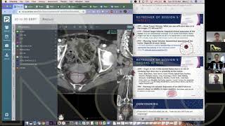 2D to 3D EBRT | Session 12 | Contouring: Introduction to ProKnow & Instructions for Uploading Cases screenshot 1