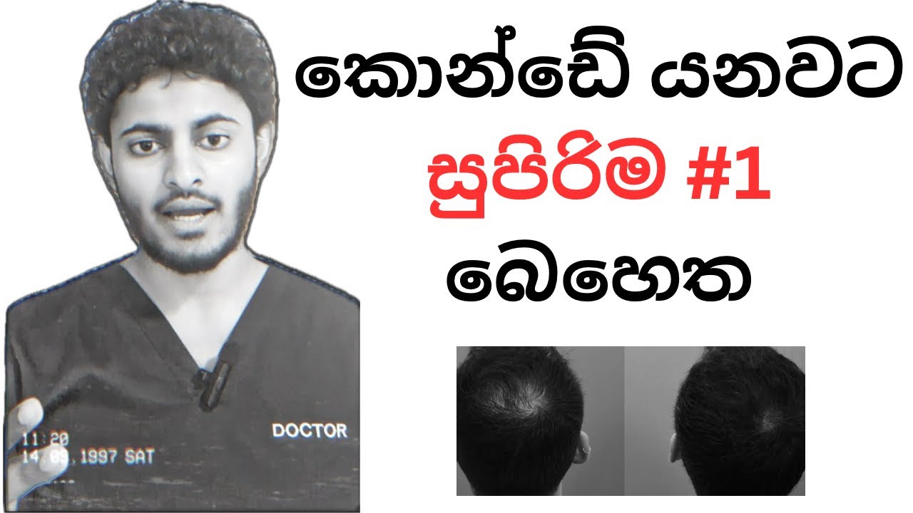 කොණ්ඩේ වැවෙන්න Finasteride පෙත්ත | Finasteride for Hairloss - Sinhala