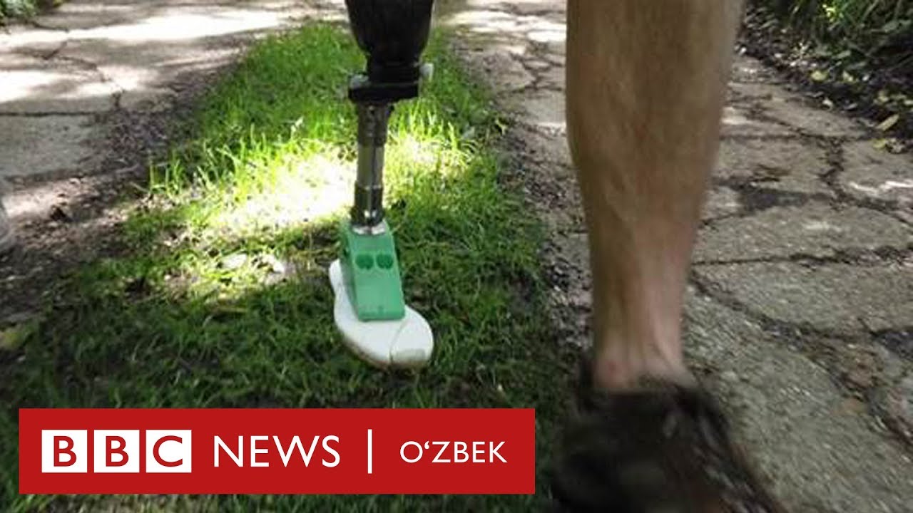 Технология янгиликлари: протезлар дунёсида инқилоб ясалдими? - BBC Uzbek