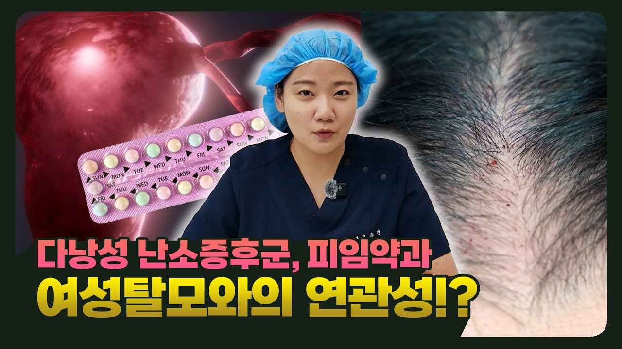 여성 탈모, 호르몬을 관리해야 하는 이유