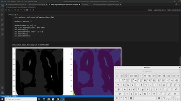 Image Segmentation Using OpenCV - CNN - Lung Cancer Complete Source code
