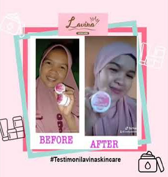 Testimonial lavina skincare