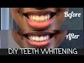 2 SIMPLE DIY HACKS FOR #WHITENINGTEETH | MORE OF AALIYAH