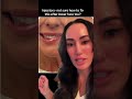 botched lower face botox. there's a fix