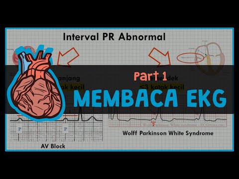 Video: Cara Baca EKG (electrocardiograph)