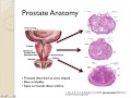 Effects of Exercise on Benign Prostatic Hyperplasia