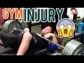 Dangerous injuries in the gym