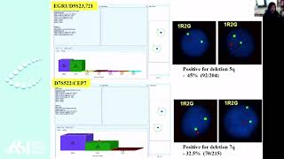 The Implementation of Semi-Automated Fish Analysis of Acute Myeloid Leukemia on Asi’s HiFISH