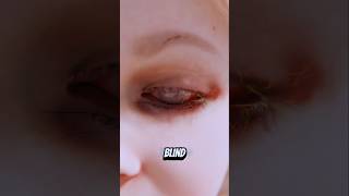 These People Bacame Permanently Blind