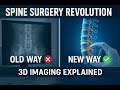 3D Imaging Is Changing Spine Surgery Forever, Here’s How