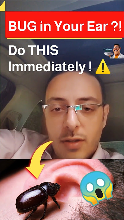 Emergency Ear Bug Removal That Actually Works at Home! | ProHealthConsults #shorts