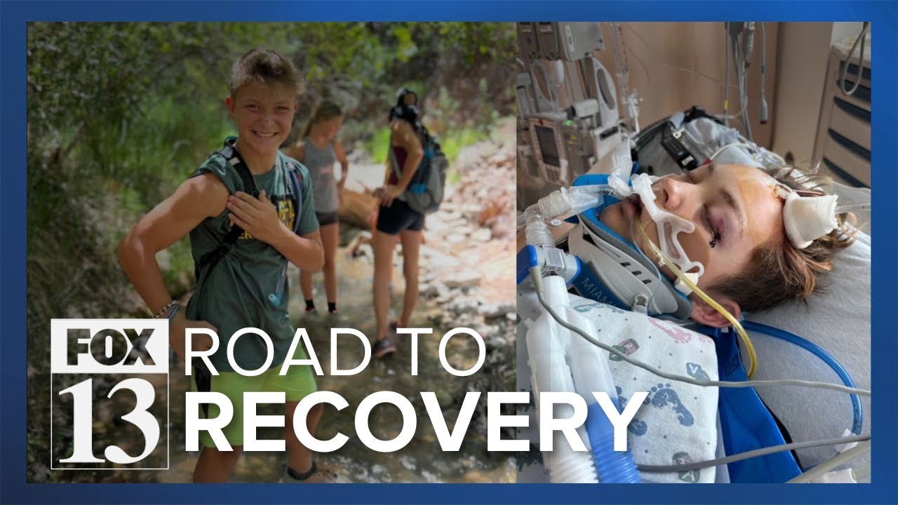 St. George teen recovering after being hit by car on e-scooter - YouTube
