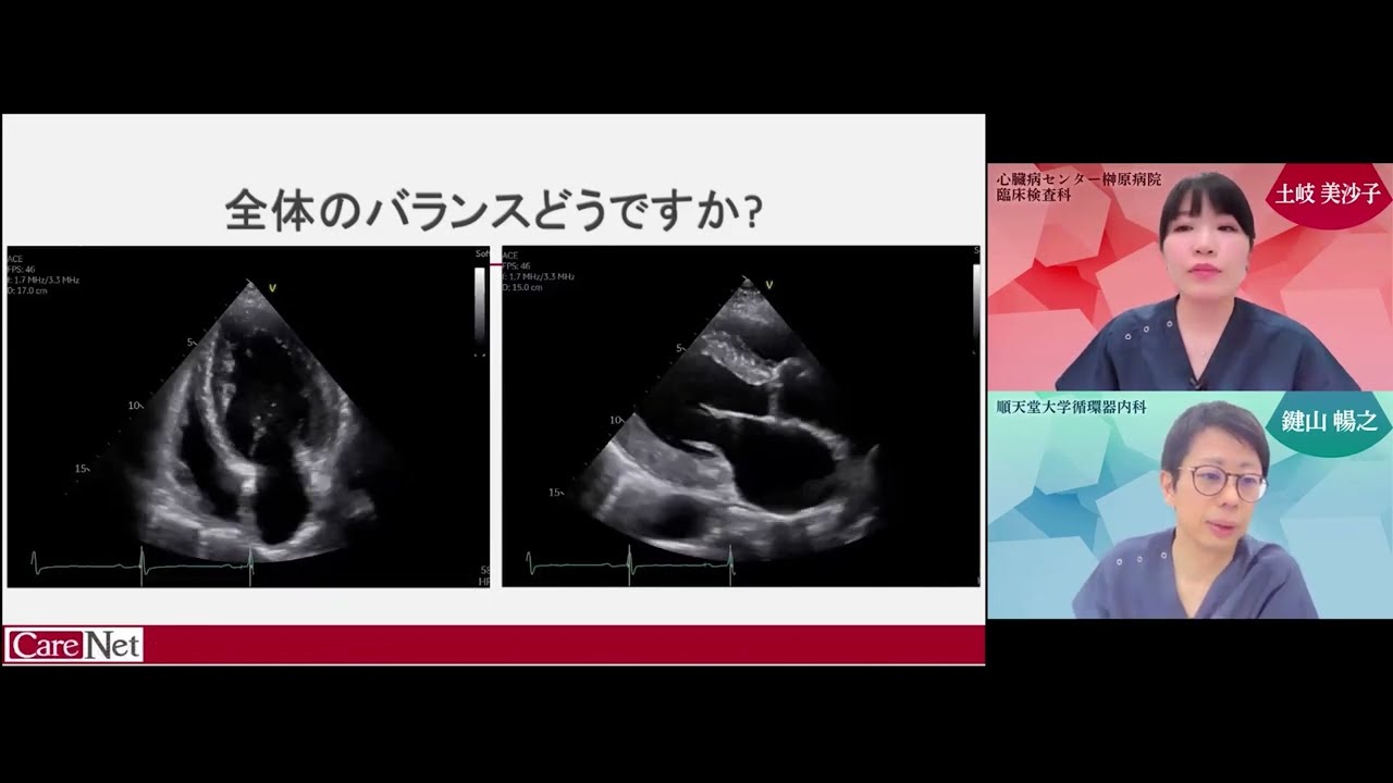 心エコー Zoomライブスキャンセミナー【S076】｜CareNeTVスクール