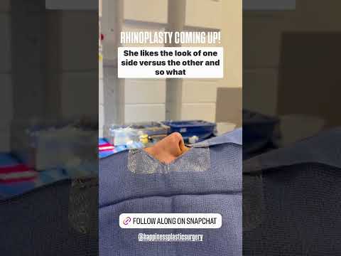 Video thumbnail: Wondering if rhinoplasty can improve the symmetry of your nose? Common questions I hear, answered. · Happiness Plastic Surgery - Dr. Weinfeld