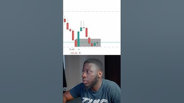 5 Pips a Day Is All You Need | Live Trading XAUUSD