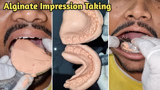 Alginate Impression Taking | Dental Impression | Alginate Impression