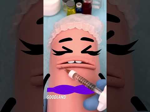 O SONHO DELA ERA FICAR COM A BOCA DE LINGUIÇA! @goodlandshort #shorts #animation