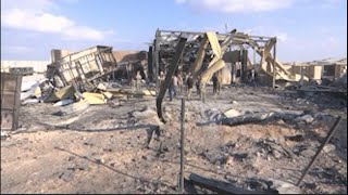 Brain injuries in Iraq shows 'unseen wounds of war'