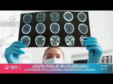 წარმოადგენს თუ არა საფრთხეს რადიოლოგიური კვლევები და რას ნიშნავს გამოსხივების დაგროვება