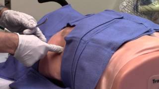 Chest Tube Placement