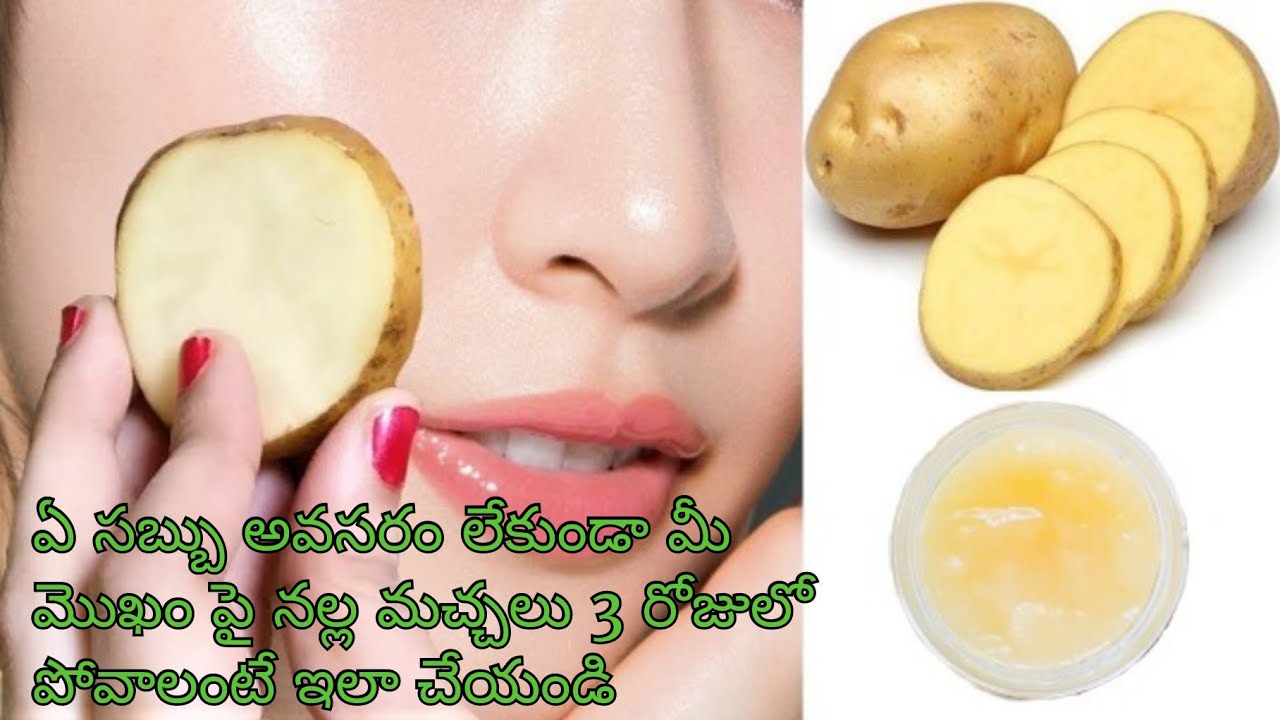 No soap apply potato gel daily on face to remove dark spots & close