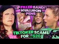 Exposing the lip filler bandit hyaluron pen disaster  tiktoker scams for 20 140