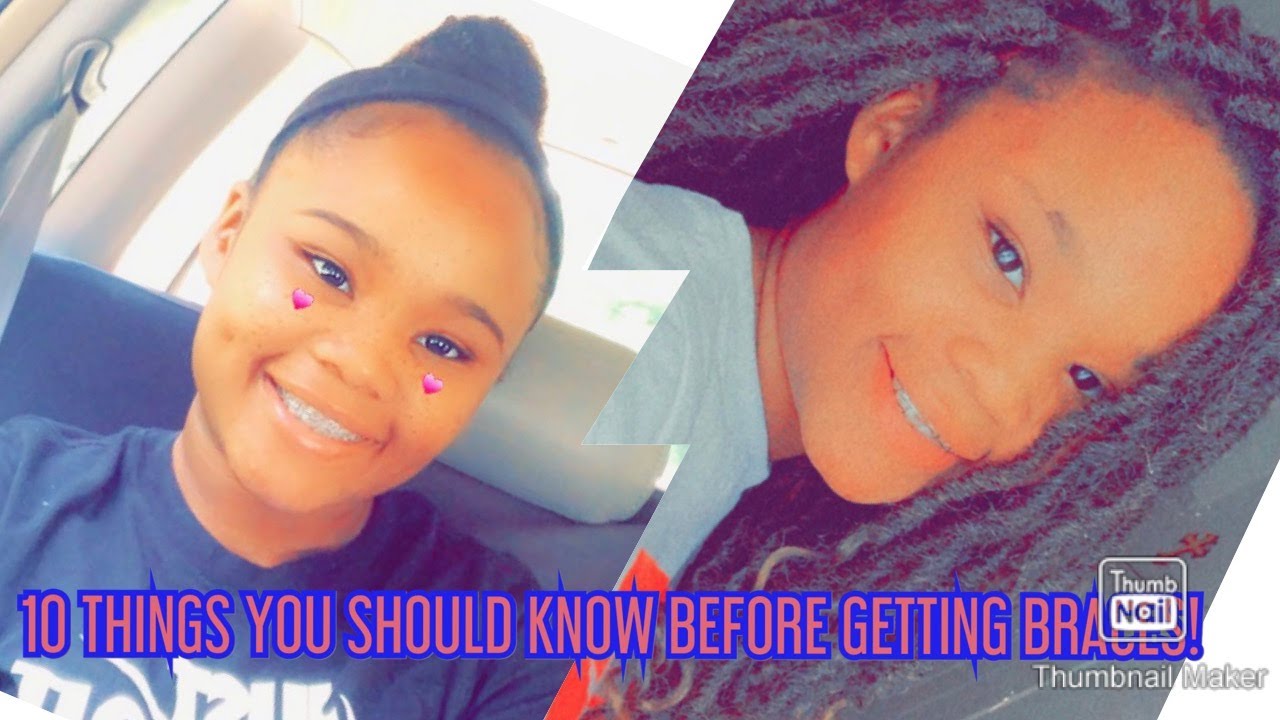 10 THINGS YOU SHOULD KNOW BEFORE GETTING BRACES! - YouTube