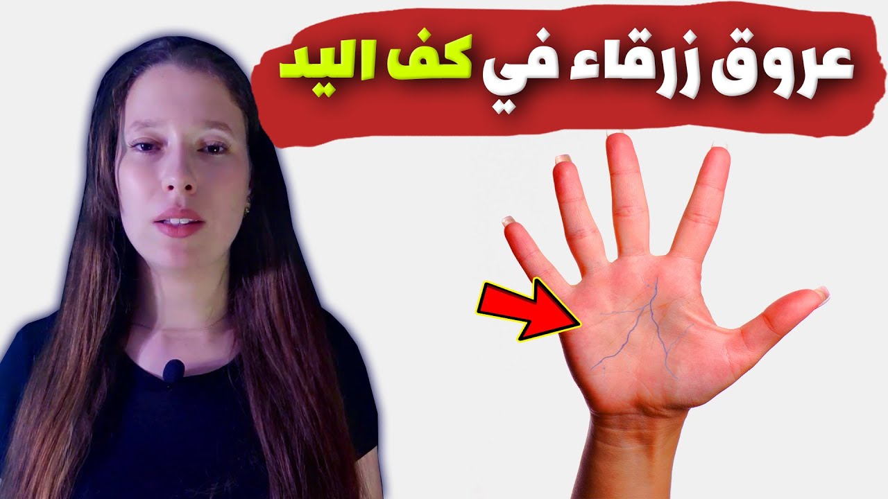 سبب ظهور عروق زرقاء في كف اليد - YouTube