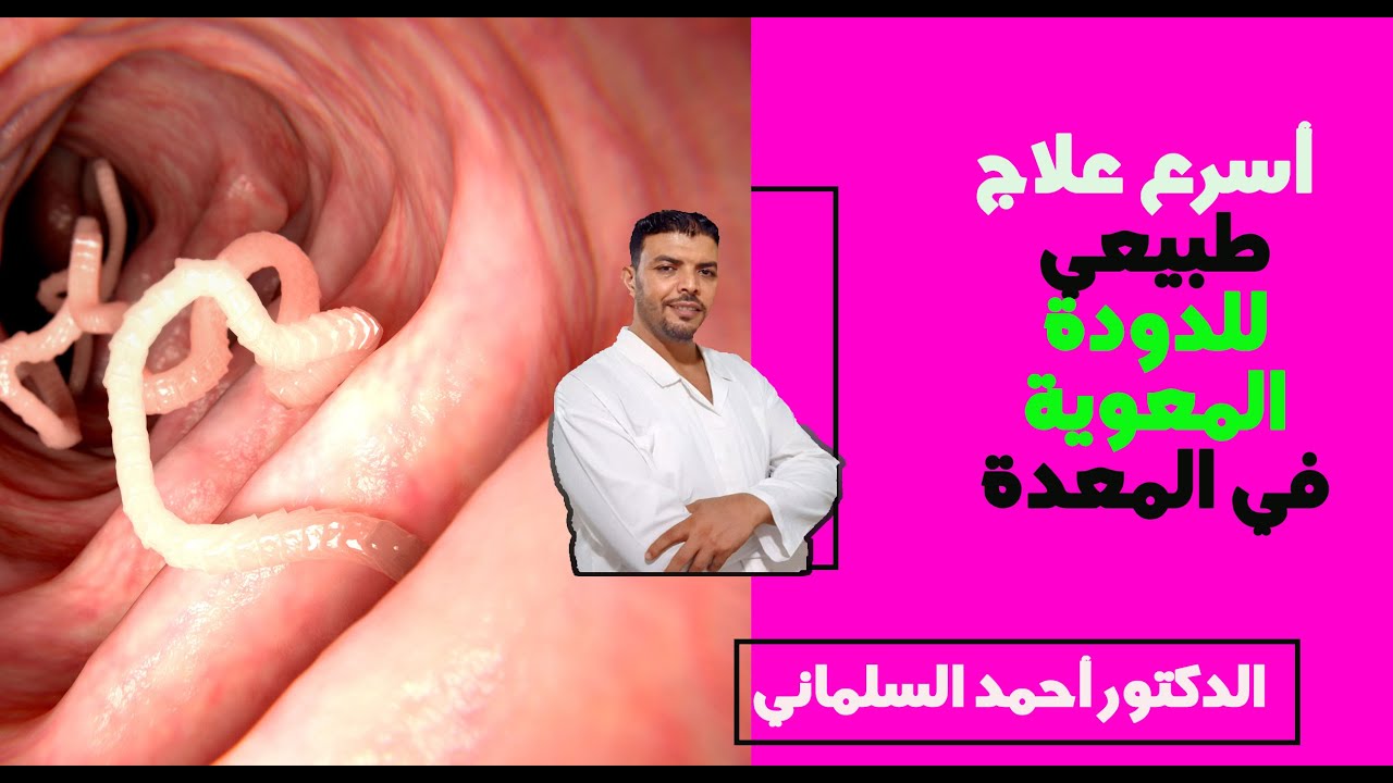 الدودة المعويةعلاج فوري لديدان المعدة والامعاء والتخلص نهائيا - YouTube