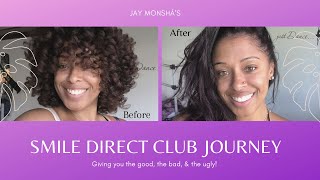 My Smile Direct Club Journey!!