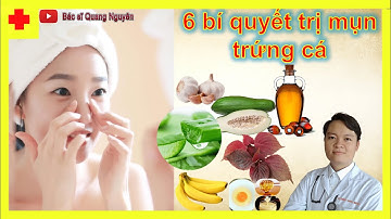 6 Bí quyết trị MỤN TRỨNG CÁ tại nhà | BS. Đoàn Quang Nguyên- Tập 024