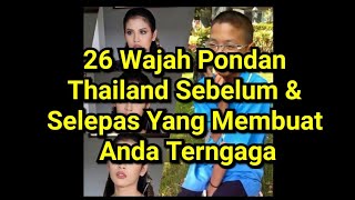 26 Wajah Pondan Thailand Sebelum & Selepas Yang Membuat Anda Terngaga