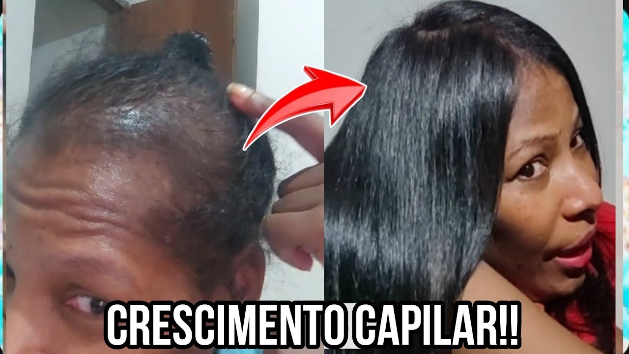 COMO ENGROSSAR UM CABELO FINO E RALO? FAÇA ISSO E TENHA UM CABELO EM BARRA!!!