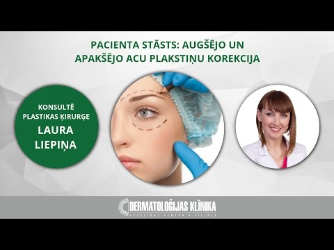 Video: Cik Veiksmīga Plastiskā ķirurģija Maina Sieviešu Dzīvi