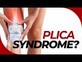 What is Plica Syndrome of the Knee, and How Do I Treat It?