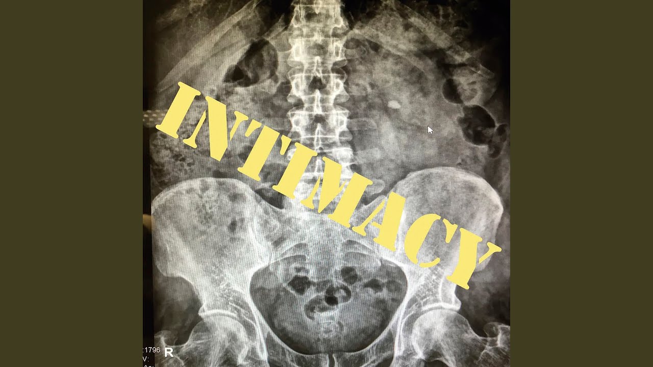 Watch Intimacy on YouTube Watch Intimacy on YouTube