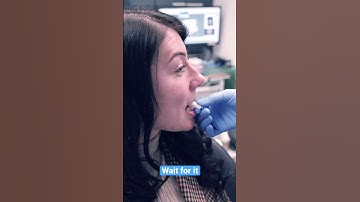 Clear aligner fitting #dentist #slowmo #teeth