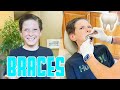 GETTING BRACES ON TOP AND BOTTOM FOR THE FIRST TIME | GETTING SIZED TO GET BRACES FOR THE FIRST TIME