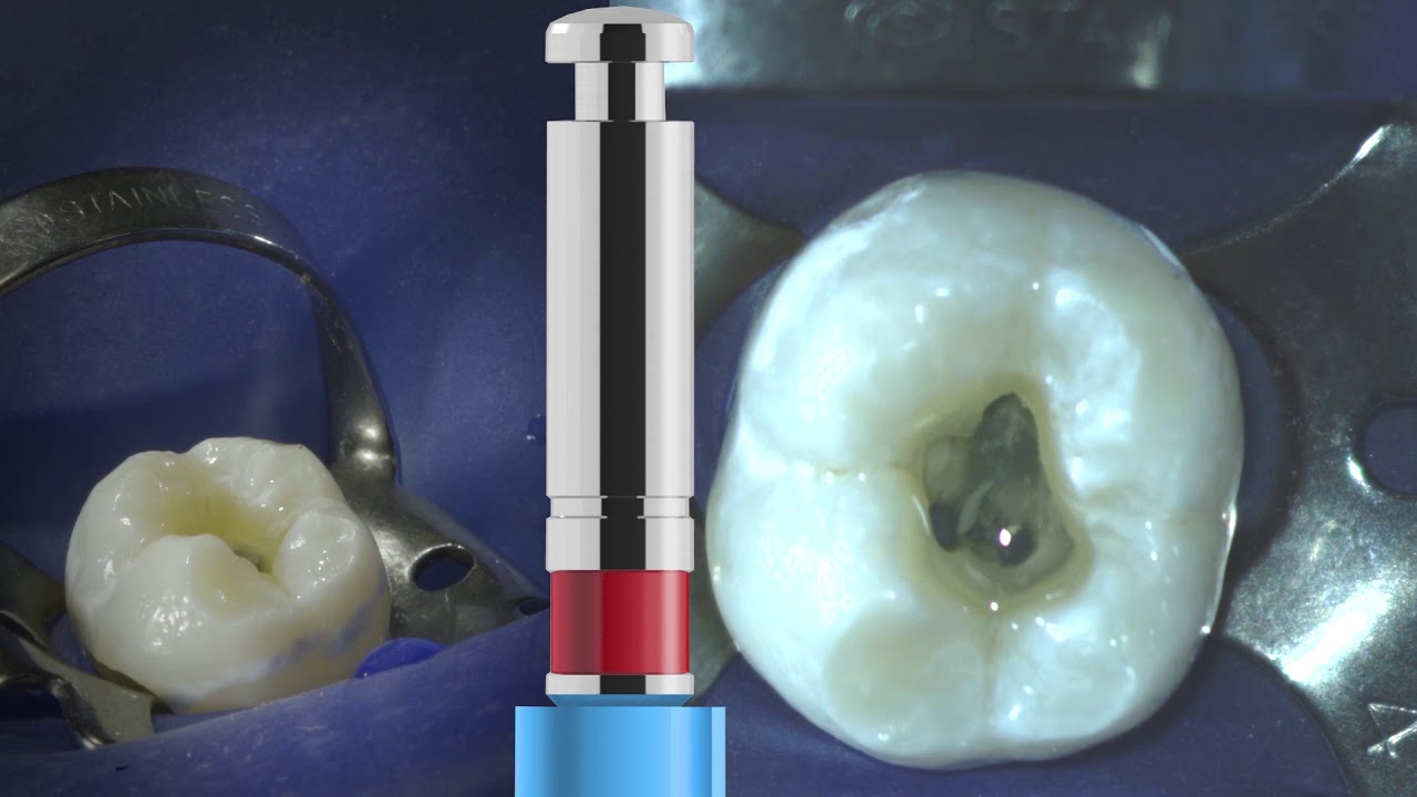 Vdw Rotation Files VDW Dental · VDW.ROTATE™ Basis Sequenz (klinisches Video) - YouTube