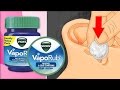 TOP 15 Surprising VICKS VAPORUB Uses You Must Know - YouTube