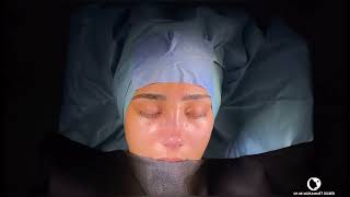BEFORE and AFTER RHINOPLASTY SURGERY YOU CAN SEE  PERFECT TRANSFORMATION SHE HAVE by MUHAMMET DILBER