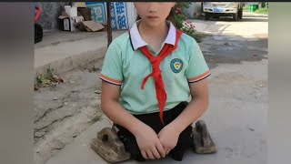 The Beautiful Girl With An Amputated Leg Is A Disability Challenge Walking Without Legs #No_Leg