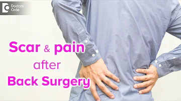 What causes scar tissue and pain after Back Surgery? - Dr. Kodlady Surendra Shetty | Doctors' Circle