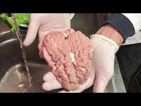 Video: Haşlanmış Beyinler