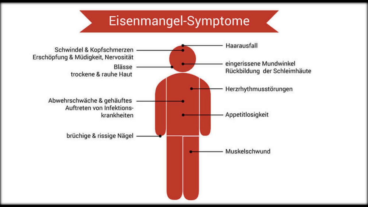 Eisenmangel Symptome, Ursachen, Folgen YouTube