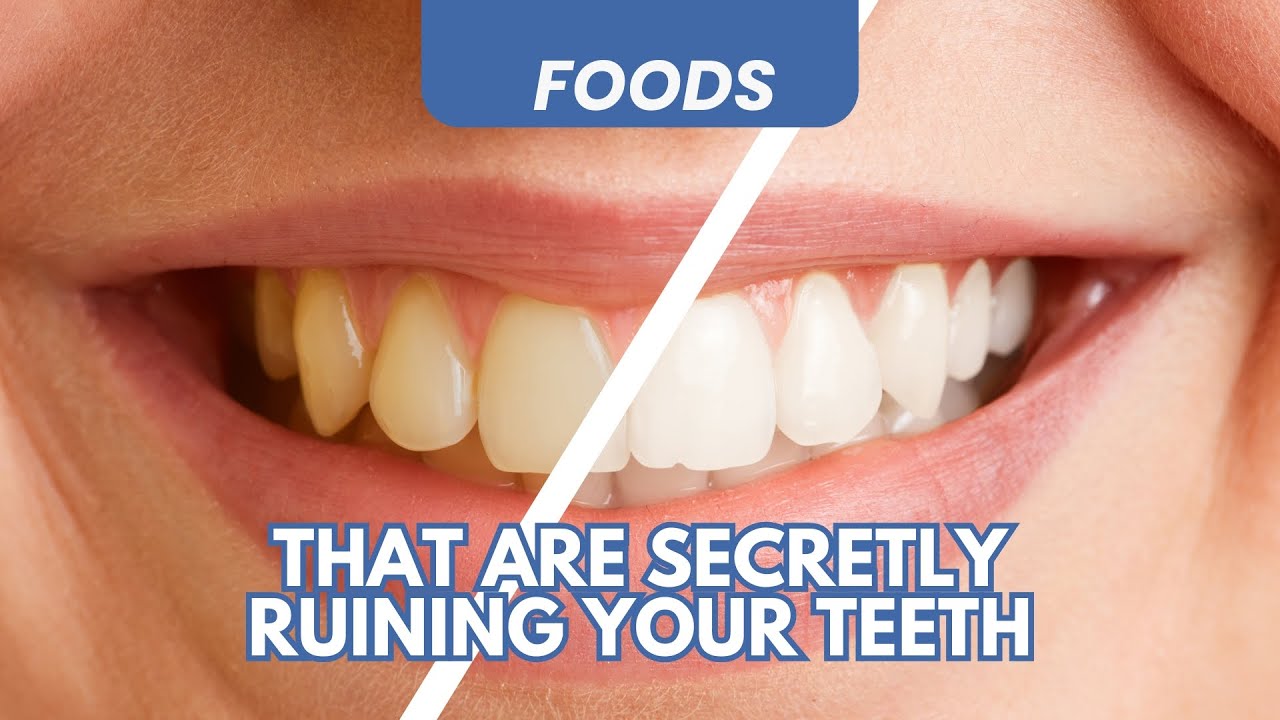 Foods That Are Secretly Ruining Your Teeth