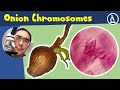 🔬 Make Onion mitosis CHROMOSOMES visible - Staining Tutorial | Amateur Microscopy