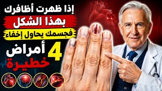 إذا ظهرت أظافرك هكذا بعد سن الستين، فقد يكون جسمك يخفي 4 أمراض