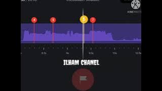 DJ ELSA LON*T HARD TYPE BEAT//STORY WA BEAT VN